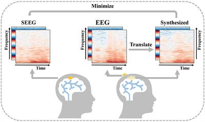 E2SGAN: EEG-to-SEEG translation with generative adversarial networks